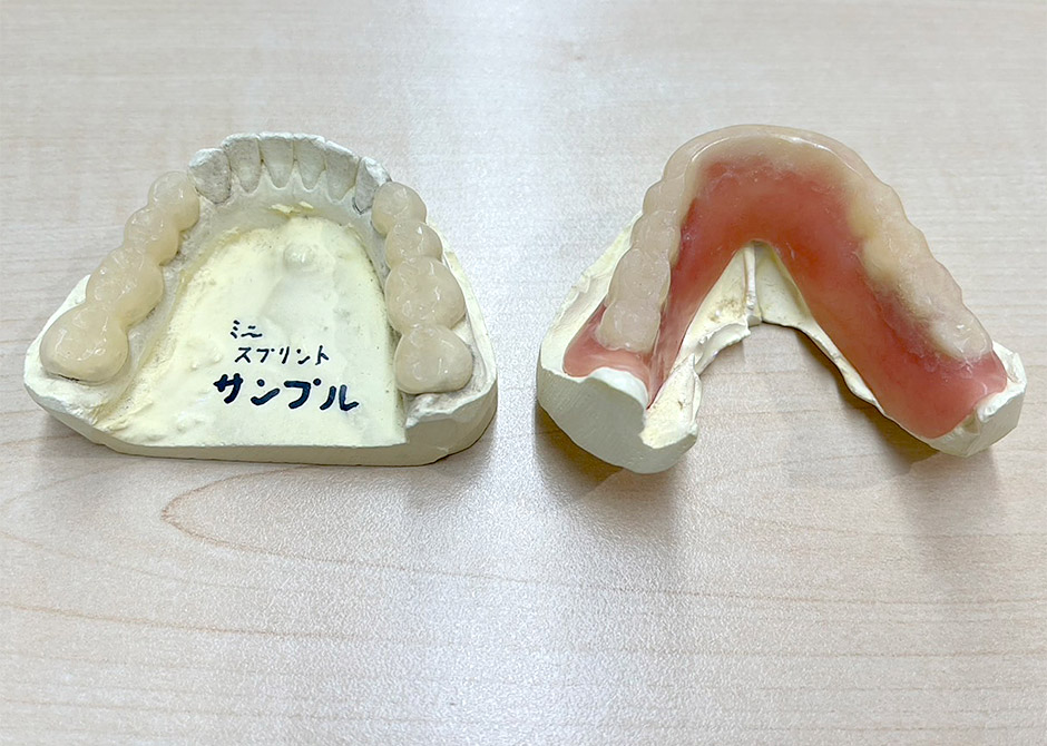 噛み合わせ