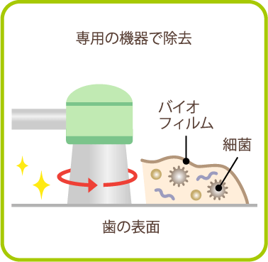 バイオフィルムの再付着を防ぐためのケア方法